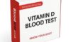 Vitamin D Blood Test: Key Insights for Residents of Colchester